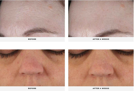 ALIGN Balancing Cream