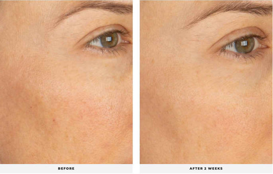 SOOTHE Barrier Concentrate