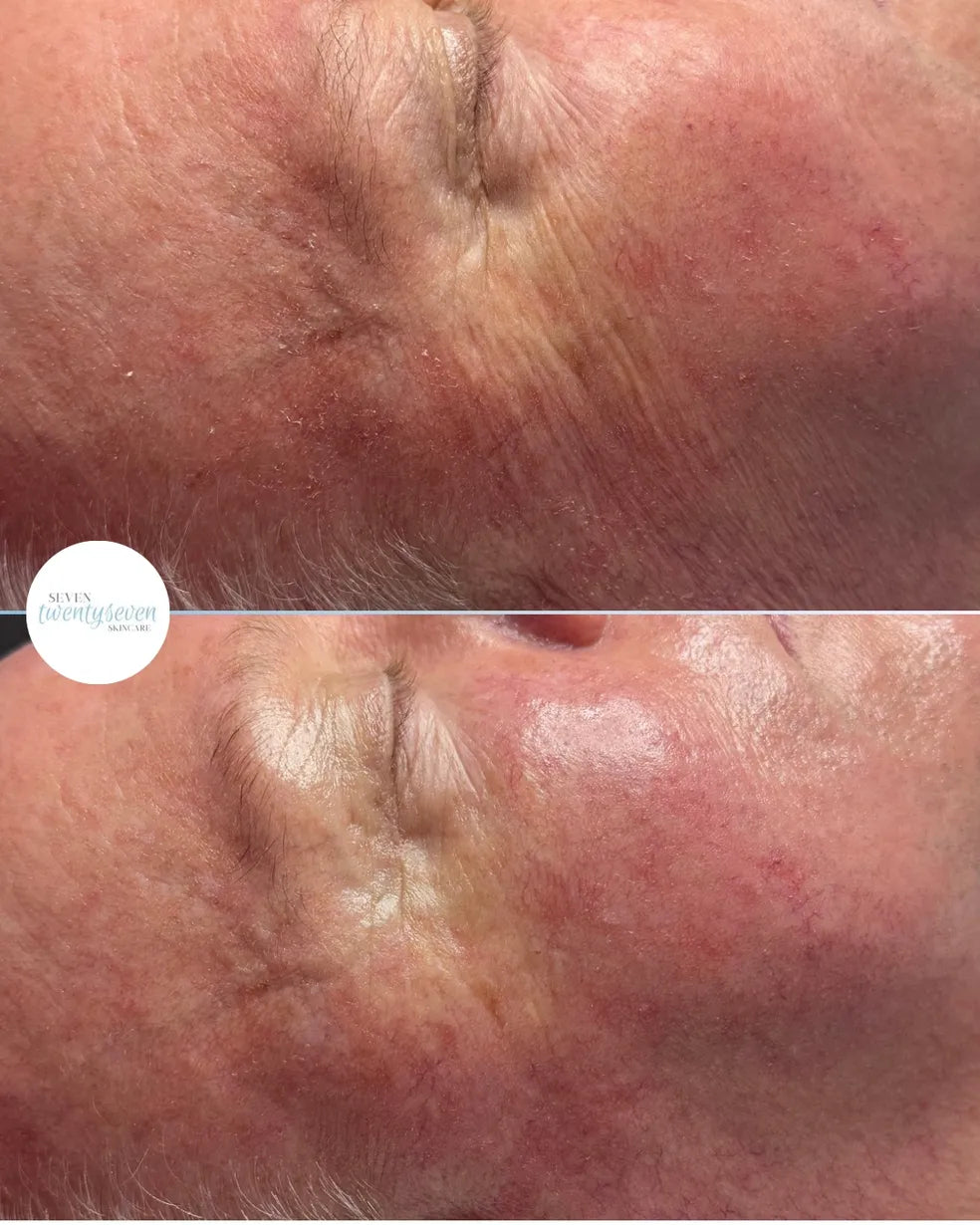 A close-up before-and-after comparison of an older person's cheek and eye area, showing skin texture and wrinkles. A white circular logo reading 'Seven Wrinkle Planner' appears on the left side.