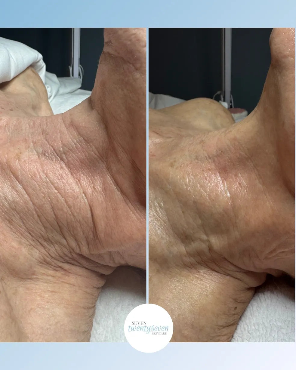 A side-by-side before and after comparison of skin texture on a person's ankle, showing wrinkled skin on the left and smoother, more hydrated skin on the right. A white circular logo at the bottom reads 'Seven Rejuvenation'.