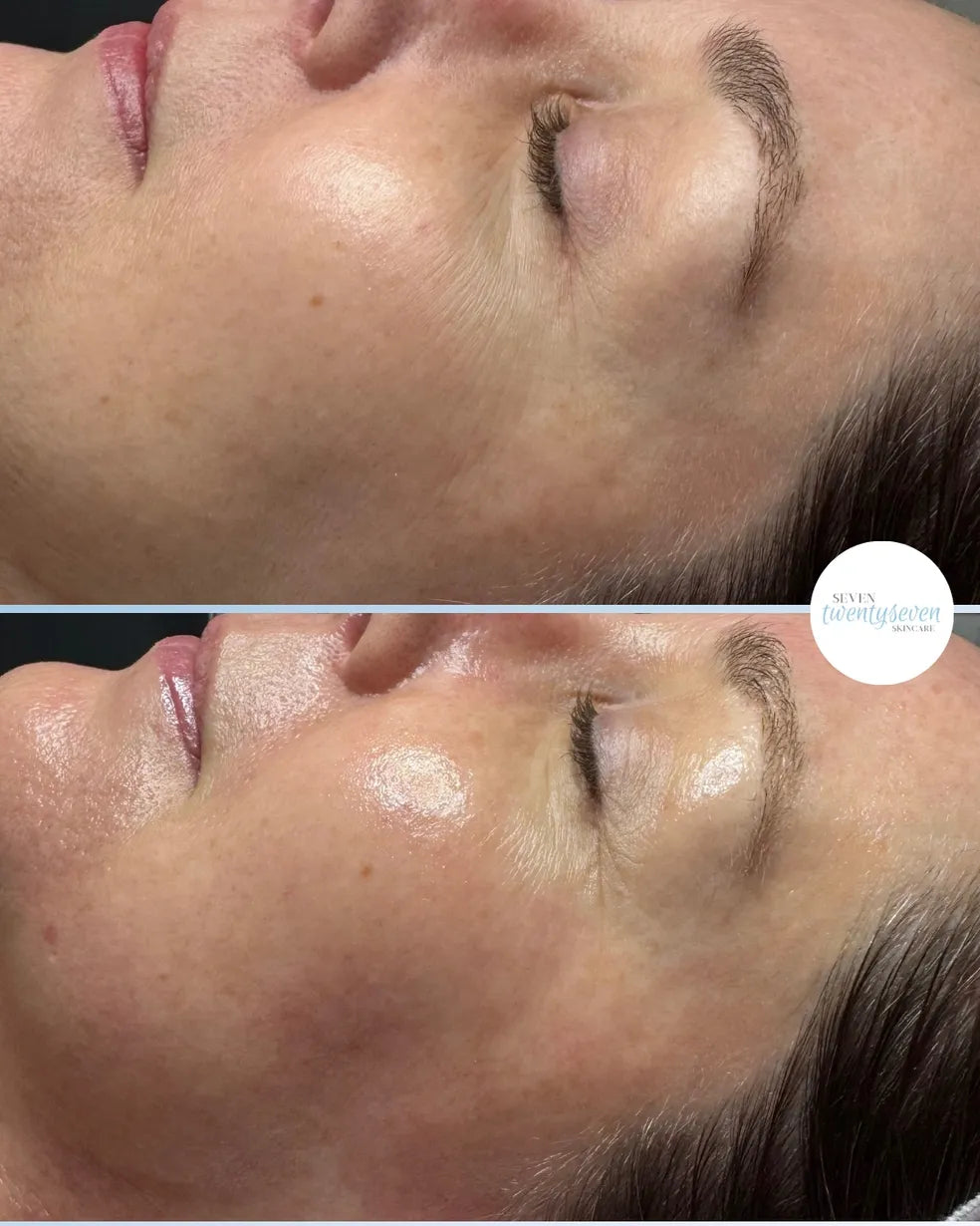 A close-up before-and-after comparison of a woman's face, focusing on the eye and cheek area, showing skincare results. A circular logo for 'Skincare Journey' is visible on the right.